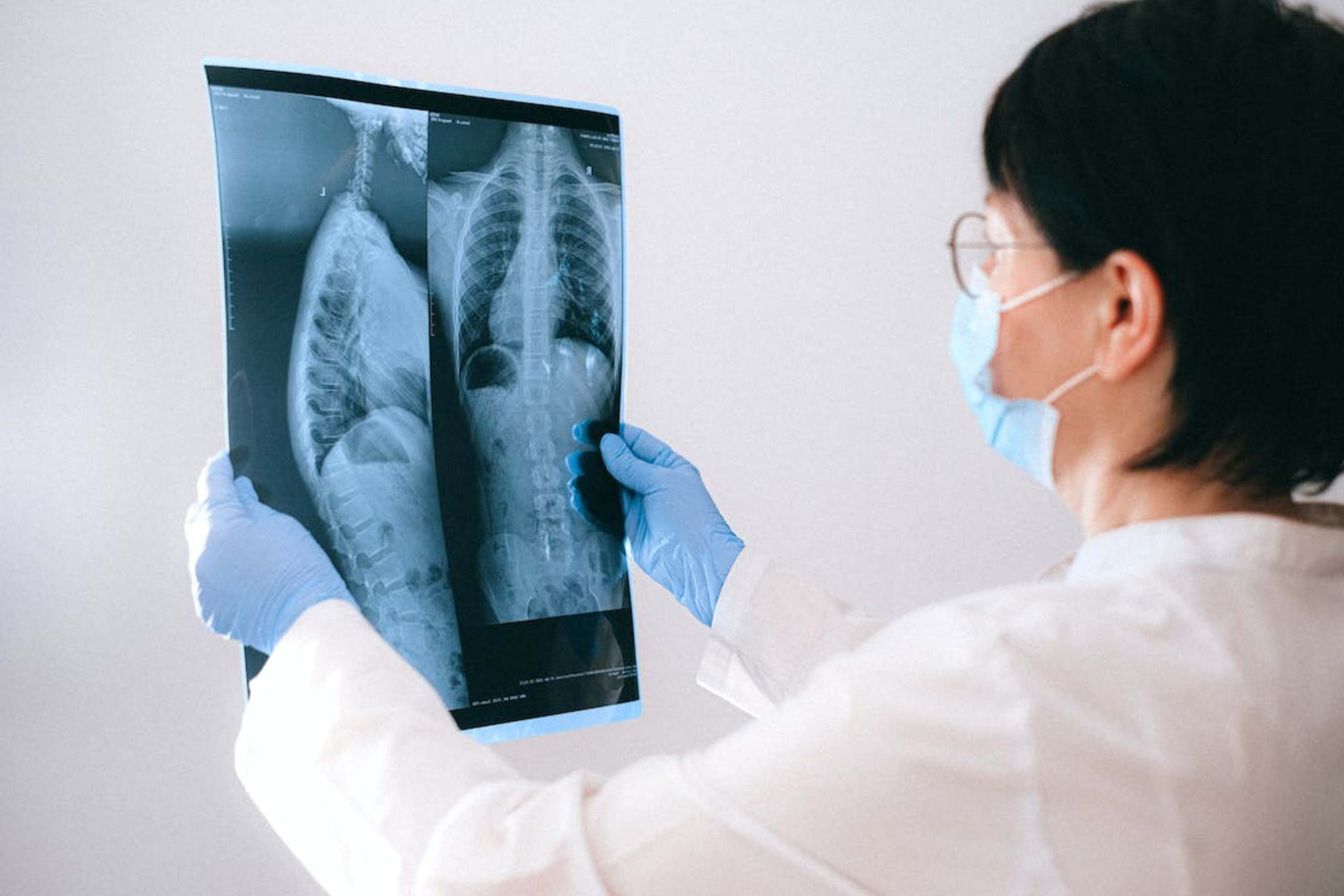 female doctor carries an x ray scan